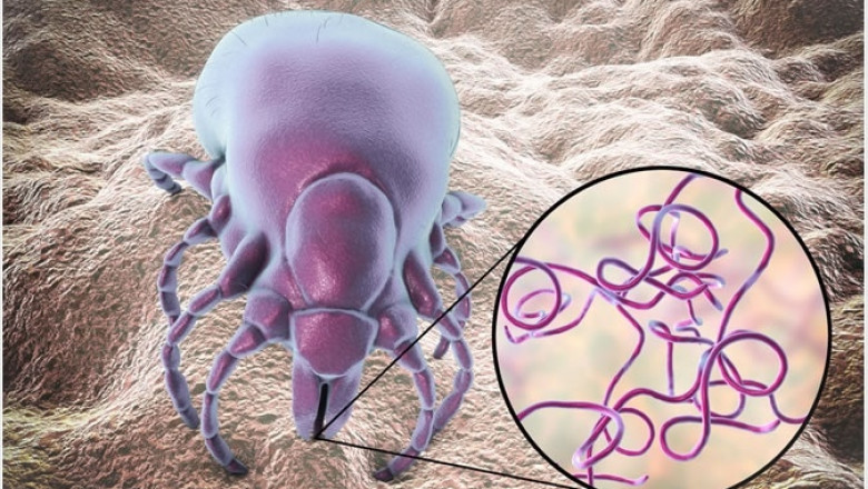Variety of Approaches To Improve The Lyme Disease Diagnostics