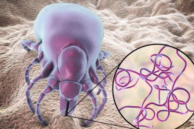 Variety of Approaches To Improve The Lyme Disease Diagnostics