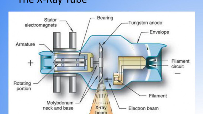 X-ray Tube Market Research | Global Industry Analysis & Forecast To 2028