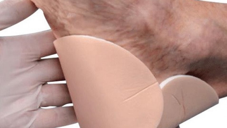 Growth in Sales of Foam Dressing Market to Push Revenue Growth in the Market