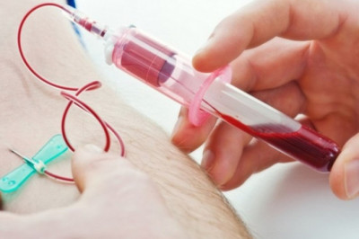 Carcinoembryonic Antigen Market 2021- Emerging Trend, Demand, Opportunities, Challenges, Growth Opportunities, Key Driven Factors