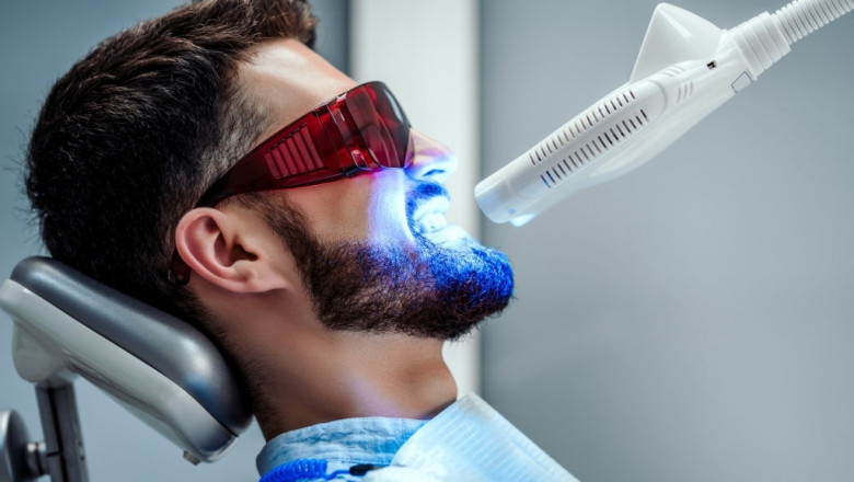 Laser Teeth Whitening