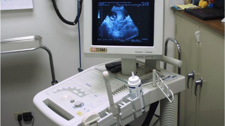 Ultrasound Devices Market Size, Share, Growth Opportunities, Business Revenue, Industry Players, Competitor Strategies 2027