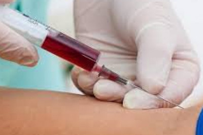 Carcinoembryonic Antigen Market Strategies, Technological Innovation, Trends & Top Players, Forecast to 2027