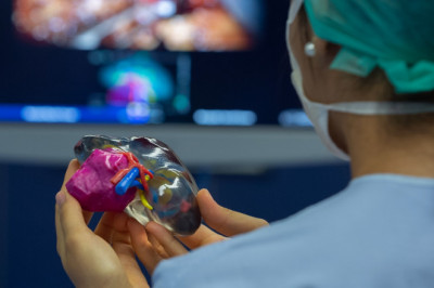 Benefits of 4d Printing in Healthcare Market Demand Forecast, Opportunities, Current Trends, Challenges, Growth Analysis, Company Profiles 2027