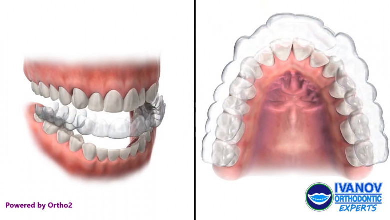 Facts To Know Before Seeing An Orthodontist!