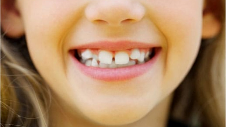 Provide Quality Pediatric Dental Care To Your Kid