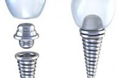 When Do You Need Emergency Dentist Services?