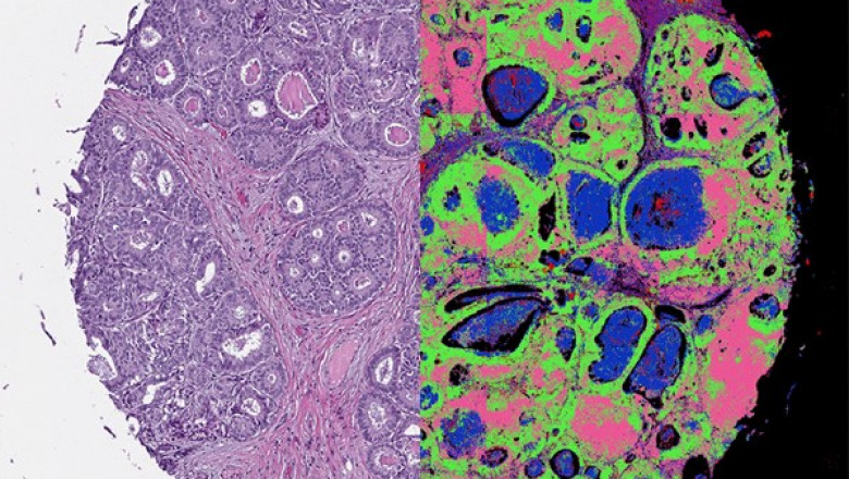 Optical imaging allows for the detection of small masses and tumors.