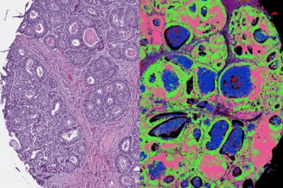 Optical imaging allows for the detection of small masses and tumors.