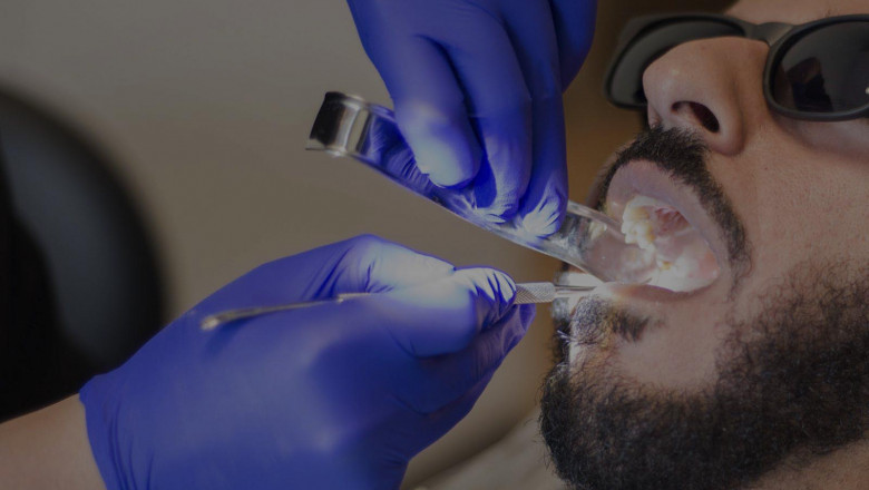 5 Reasons To Get Your Teeth Professionally Cleaned :