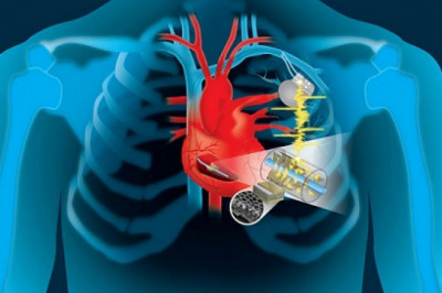 Structural Heart Device Variety of Heart Defects that a Person can be Born with or can Acquire over Time