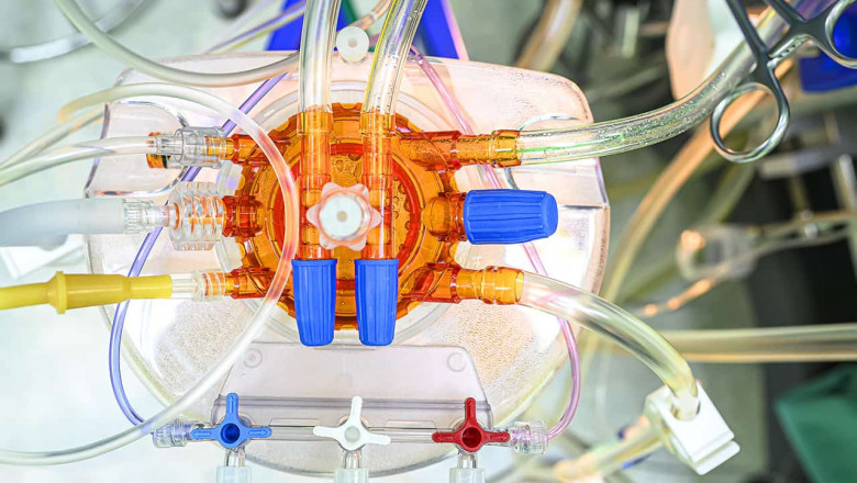 Medical Tubing Market - Global Company Analysis, Size, Share, Growth, Trends and Forecast 2018 - 2026