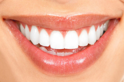 Dental Veneers: What Should You Need To Know?