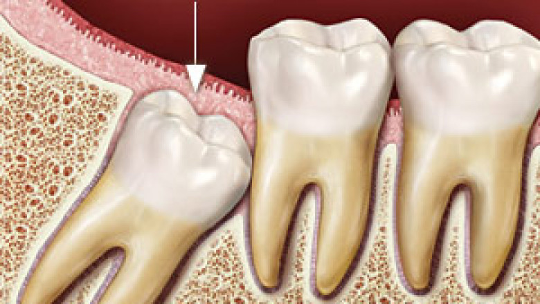 Which is an advanced Dental Clinic for Oral Surgery in Livingstone?