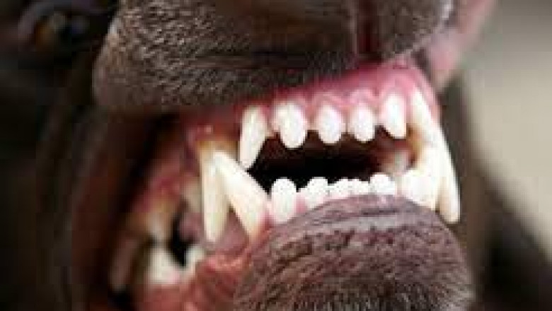 Accident Claims in Menifee