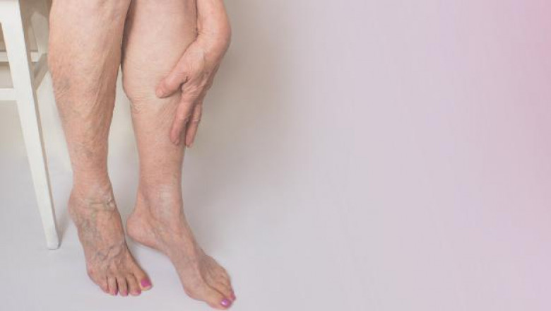 Harvard Trained Vein Doctors | Top NY Vein Clinic 2020