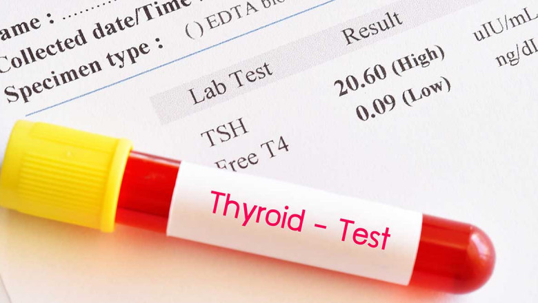 Thyroid Function Test Market Report 2021 | Industry Growth, Share, Size, Demand Market Analysis 2026