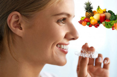 Foods, Beverages and Other Things to be Avoided While Using Invisalign