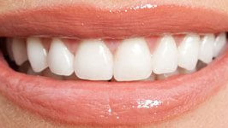 Looking for Wisdom teeth removal?
