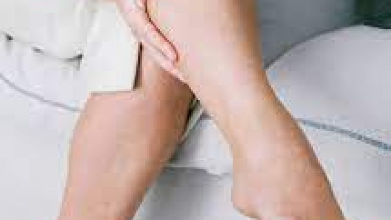 Different Stages Of Vein disease: