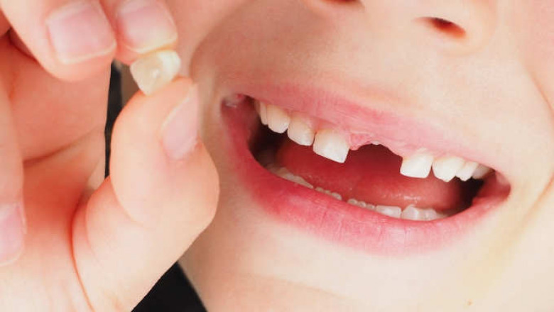 What Are Baby Teeth And When Do Kids Start Losing Teeth?