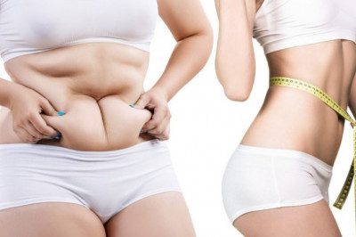 Radiofrequency For Skin Tightening