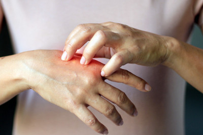 Various Ways To Do Systemic Scleroderma Treatment.