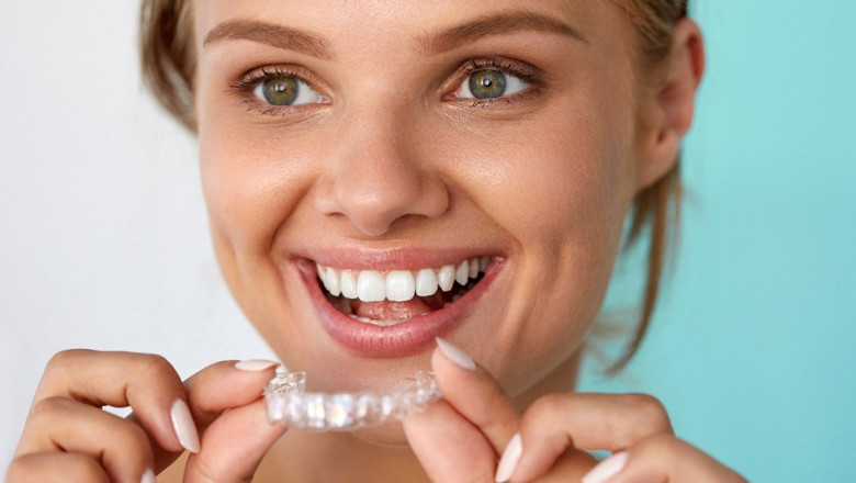 What Are The Top Tips To Be Followed By The People At The Time Of Choosing The Perfect Invisalign Dentist In Bandra?