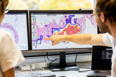 Cancer Diagnostics Market Amid Covid-19 Crisis To Bolster in Years Ahead | Industry Analysis by Business Trends, Global Segments, Industry Profit Growth 2027