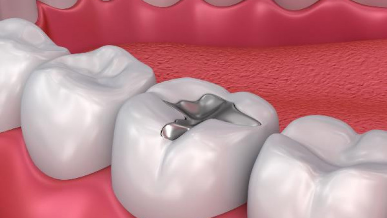 Are Walk-in Dental Clinics are Reliable and Significant?