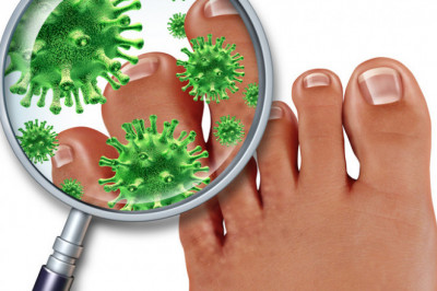 Antifungal Drugs come in a variety of forms.