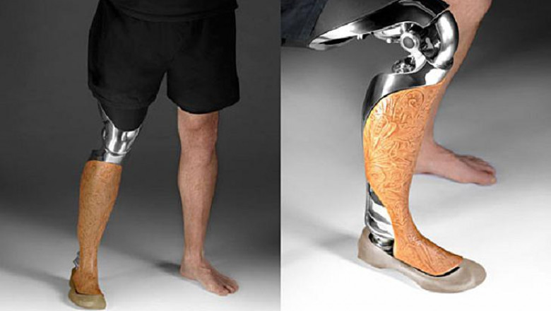 Global 3d Printed Medical Devices Market Analysis Report, 2018-2026