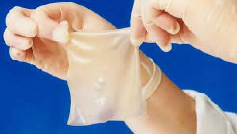 Skin Replacement Market : Size, Share & Trends