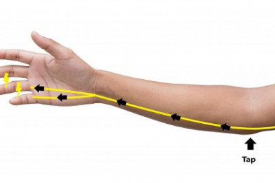 Ulnar Nerve Treatment Market to Witness High Growth, Dynamics, Production, Demand Analysis and Forecast 2021-2028