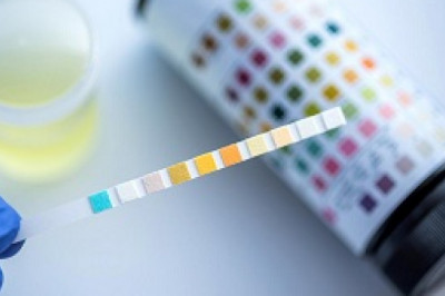 Synthetic Urine - Don’t Miss The Opportunity