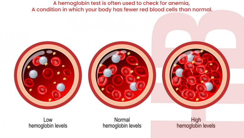 Haemoglobin Hb in Amritsar - Meddco
