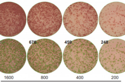 ELISpot Market by Business Development, Innovation and Top Companies Forecast 2021-2028