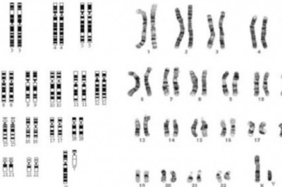 Karyotyping Market Regulations and Competitive Landscape Outlook 2021 to 2028