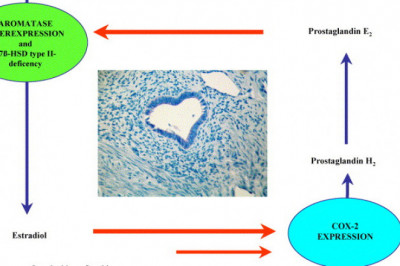 Cyclooxygenase 2 Inhibitor Market 2021 Industry Outlook, Present Scenario of Manufacturers, Channels Analysis and Forecast Research Study 2028