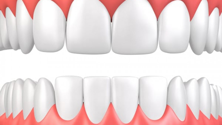 Non-Surgical Gum Treatment