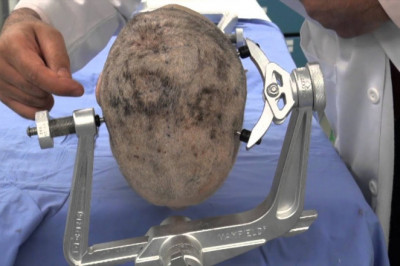 An instrument with serrated jaws and locking handles that can hold, join, hold, or support an organ is called a clamp.