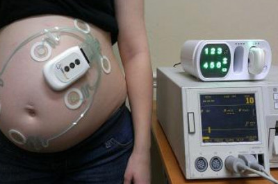 Intrapartum Monitoring Devices Market Growth Statistics, Driving Factors and Industry Growth Trends 2028