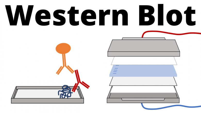 2021 Preview and Analysis: Western Blotting Market by Product Type – Automated Dry, Semi-Dry, and Traditional Wet Transfer Blotting Systems for 2021 – 2031