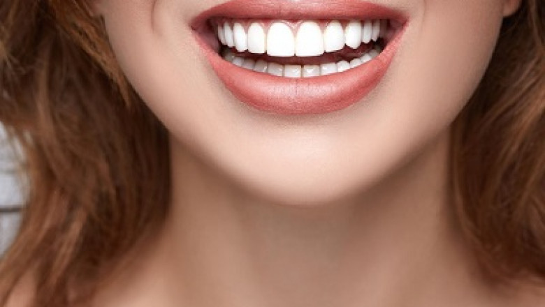 In-Office Teeth Whitening Procedure
