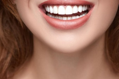 In-Office Teeth Whitening Procedure