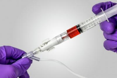 Closed System Transfer Devices Market 2021 - Top Manufacturers, Latest Trends, Future Prospects and Forecast 2028