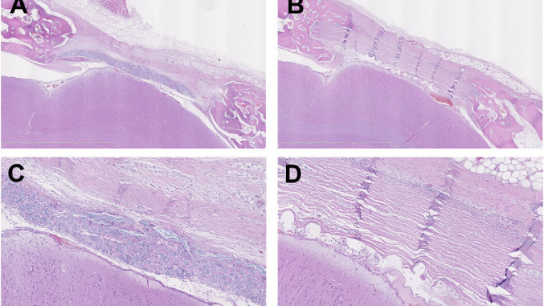Biological Dural Repair Market Growth Factors, Business Developments and Competitive Landscape Outlook 2021 to 2028