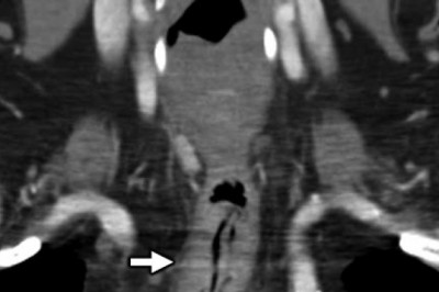 Secondary Otalgia Market 2021 Industry Research, Share, Trend, Price, Future Analysis, Regional Outlook to 2028