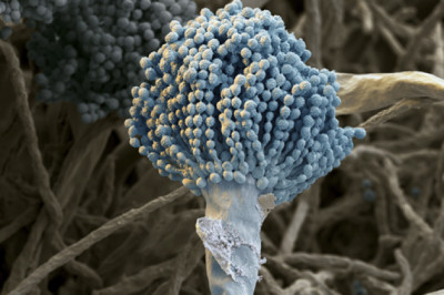 Trends in Aspergillosis Treatment Market